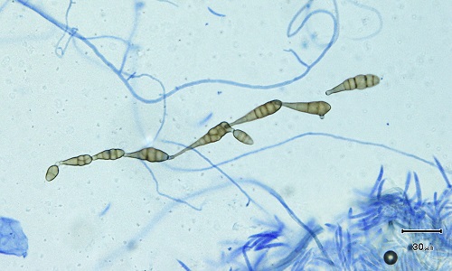 Ioos_Alternaria_sp.jpg