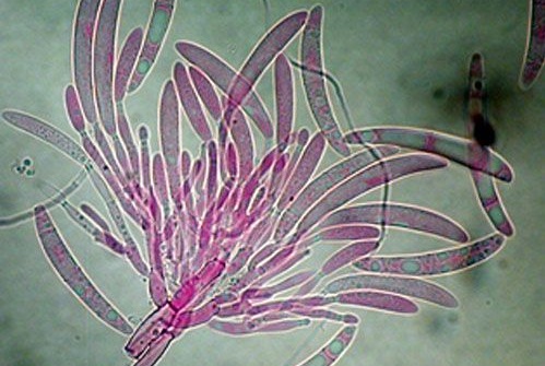 conidiophore2.jpg